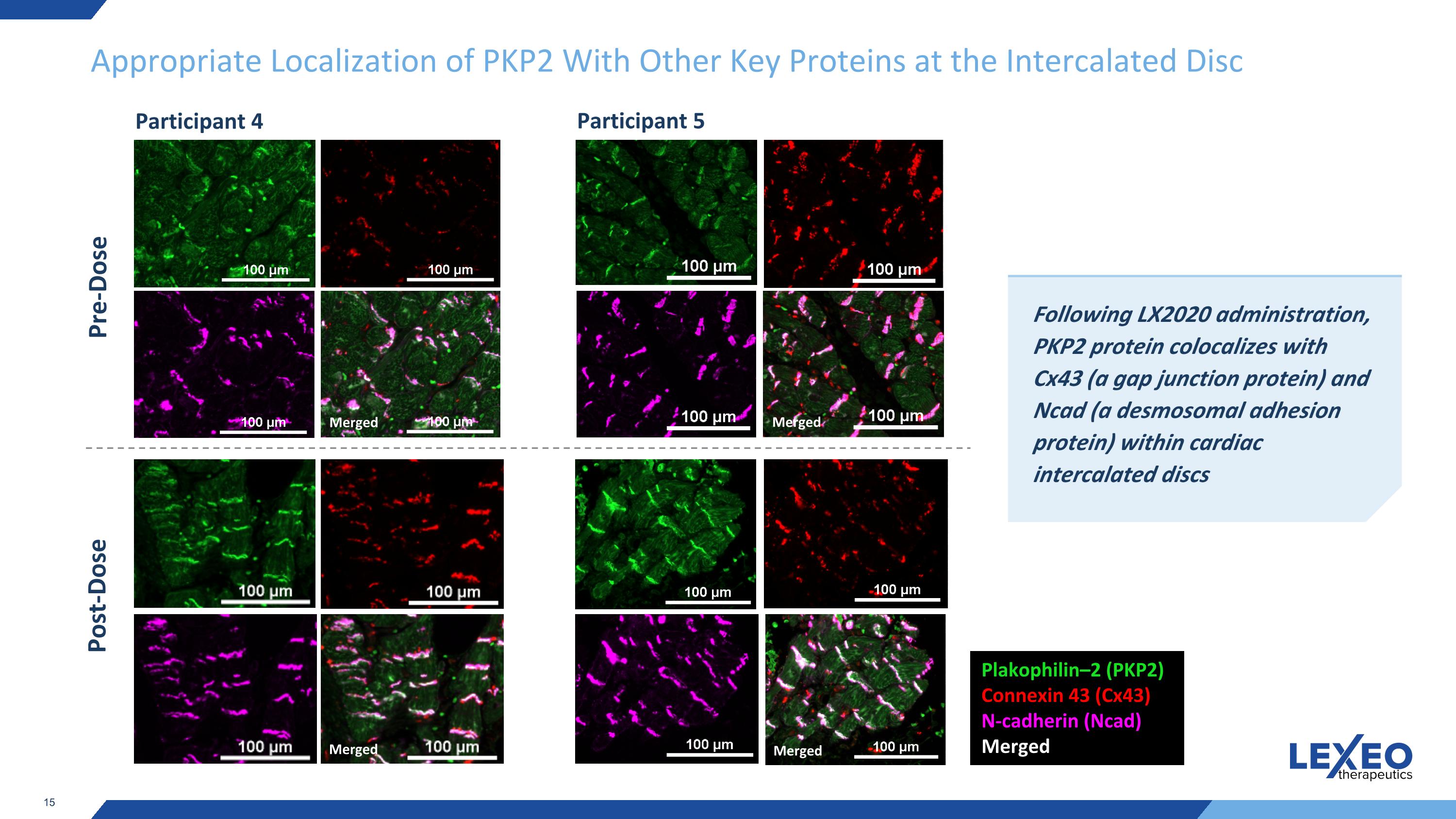 Slide 15
